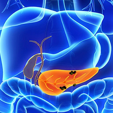 Barrie GI - Pancreatic Disease 