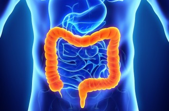 Barrie Gastroenterology - Ulcerative Colitis